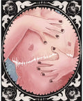 Post Op PRiNT by Spawn's Art